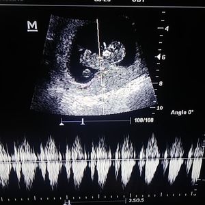 Meet your Posher, Iris